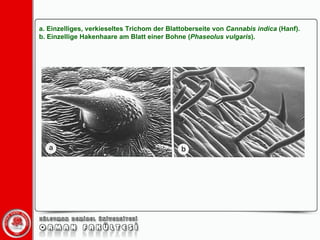 a. Einzelliges, verkieseltes Trichom der Blattoberseite von  Cannabis   indica  (Hanf). b. Einzellige Hakenhaare am Blatt einer Bohne ( Phaseolus   vulgaris ).  