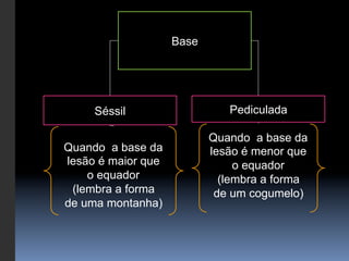 Base




     Séssil                   Pediculada

                           Quando a base da
Quando a base da           lesão é menor que
lesão é maior que               o equador
    o equador                (lembra a forma
 (lembra a forma            de um cogumelo)
de uma montanha)
 