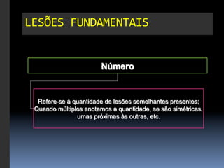 LESÕES	
  FUNDAMENTAIS	
  


                        Número


  Refere-se à quantidade de lesões semelhantes presentes;
 Quando múltiplos anotamos a quantidade, se são simétricas,
               umas próximas às outras, etc.
 