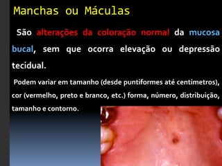 Manchas	
  ou	
  Máculas	
  
	
   São	
   alterações	
   da	
   coloração	
   normal	
   da	
   mucosa	
  
bucal,	
   sem	
   que	
   ocorra	
   elevação	
   ou	
   depressão	
  
tecidual.	
  
	
   Podem	
   variar	
   em	
   tamanho	
   (desde	
   puntiformes	
   até	
   centímetros),	
  
cor	
   (vermelho,	
   preto	
   e	
   branco,	
   etc.)	
   forma,	
   número,	
   distribuição,	
  
tamanho	
  e	
  contorno.	
  
 