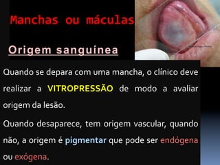 Manchas	
  ou	
  máculas	
  

  Origem sanguínea
Quando	
  se	
  depara	
  com	
  uma	
  mancha,	
  o	
  clínico	
  deve	
  
realizar	
   a	
   VITROPRESSÃO	
   de	
   modo	
   a	
   avaliar	
  
origem	
  da	
  lesão.	
  	
  

Quando	
   desaparece,	
   tem	
   origem	
   vascular,	
   quando	
  
não,	
  a	
  origem	
  é	
  pigmentar	
  que	
  pode	
  ser	
  endógena	
  
ou	
  exógena.	
  
 
