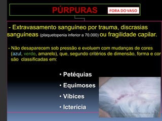 PÚRPURAS                    FORA	
  DO	
  VASO	
  



 - Extravasamento sanguíneo por trauma, discrasias
sanguíneas (plaquetopenia inferior a 70.000) ou fragilidade capilar.

- Não desaparecem sob pressão e evoluem com mudanças de cores
  (azul, verde, amarelo), que, segundo critérios de dimensão, forma e cor
  são classificadas em:


                        •  Petéquias
                        •  Equimoses
                        •  Víbices
                        •  Icterícia
 