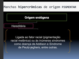 Manchas	
  hipercrômicas	
  de	
  origem	
  PIGMENTAR	
  

                Origem endógena


      Hereditária


         Ligada ao fator racial (pigmentação
     racial melânica) ou às inúmeras síndromes
        como doença de Addison e Síndrome
            de Peutz-jeghers, entre outras.
 