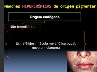 Manchas	
  HIPERCRÔMICAS	
  de	
  origem	
  pigmentar	
  

               Origem endógena

   Não hereditários



      Ex.: efélides, mácula melanótica bucal,
                  nevo e melanoma
 