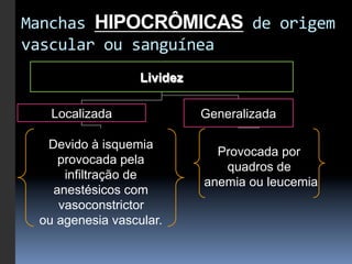 Manchas	
  HIPOCRÔMICAS	
  de	
  origem	
  
vascular	
  ou	
  sanguínea	
  
                   Lividez

    Localizada               Generalizada

   Devido à isquemia
                               Provocada por
     provocada pela
                                quadros de
      infiltração de
                             anemia ou leucemia
    anestésicos com
     vasoconstrictor
  ou agenesia vascular.
 