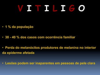 V I T I L I G O

•  1 % da população


•  30 - 40 % dos casos com ocorrência familiar


•  Perda do melanócitos produtores de melanina no interior
da epiderme afetada


•  Lesões podem ser inaparentes em pessoas de pele clara
 