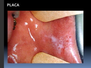 PLACA	
  


       	
  	
  
 