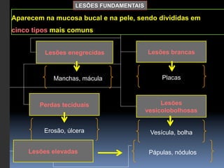 LESÕES FUNDAMENTAIS

Aparecem na mucosa bucal e na pele, sendo divididas em
cinco tipos mais comuns


         Lesões enegrecidas              Lesões brancas



            Manchas, mácula                   Placas



        Perdas teciduais                      Lesões
                                         vesicolobolhosas


         Erosão, úlcera                   Vesícula, bolha


    Lesões elevadas                       Pápulas, nódulos
 