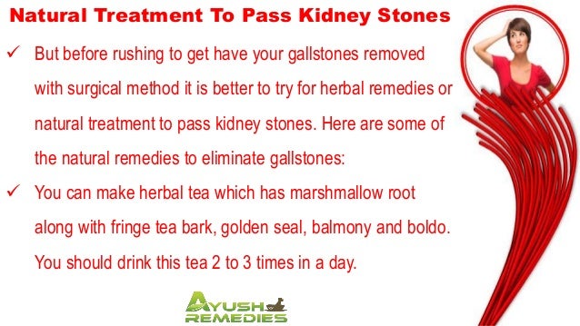 Natural Treatment To Pass Kidney Stones Without Side Effects