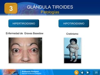 GLÁNDULA TIROIDES
  3                               Patologías

     HIPERTIROIDISMO                           HIPOTIROIDISMO


Enfermedad de Graves Basedow                     Cretinismo




           Anatomía Humana
           Manuel Arrelucea Delgado                             25
 