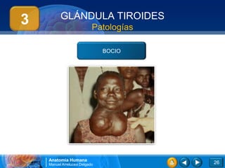 GLÁNDULA TIROIDES
3                          Patologías

                               BOCIO




    Anatomía Humana
    Manuel Arrelucea Delgado            26
 