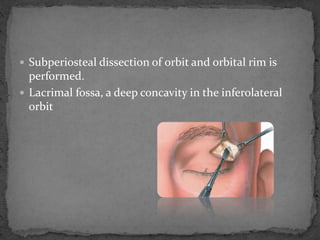  Subperiosteal dissection of orbit and orbital rim is
performed.
 Lacrimal fossa, a deep concavity in the inferolateral
orbit
 