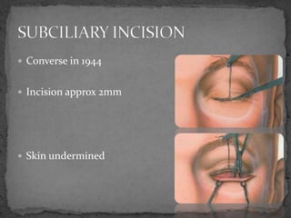  Converse in 1944
 Incision approx 2mm
 Skin undermined
 