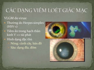 VLGM do virus:
 Thường do Herpes simplex
(HSV-1)
 Tiềm ẩn trong hạch thần
kinh V => tái phát
 Hình dạng đặc thù
 Nông: cành cây, bản đồ
 Sâu: dạng đĩa, đốm
 
