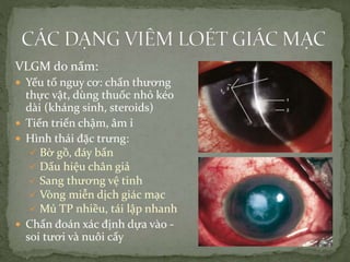 VLGM do nấm:
 Yếu tố nguy cơ: chấn thương
thực vật, dùng thuốc nhỏ kéo
dài (kháng sinh, steroids)
 Tiến triển chậm, âm ỉ
 Hình thái đặc trưng:
 Bờ gồ, đáy bẩn
 Dấu hiệu chân giả
 Sang thương vệ tinh
 Vòng miễn dịch giác mạc
 Mủ TP nhiều, tái lập nhanh
 Chẩn đoán xác định dựa vào -
soi tươi và nuôi cấy
 