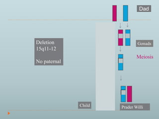 Dad 
PraderWilli 
Deletion 
15q11-12 
No paternal 
Meiosis 
 