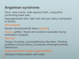 Angelman syndrome 
Face: wide mouth, wide-spaced teeth, prognathia 
(protruding lower jaw) 
Hypopigmented skin, light hair and eye colour (compared 
to family) 
Microcephaly 
Severe developmental delay (speech) 
Ataxia, uplifted, flexed arm position especially during 
ambulation (puppet) 
Seizures 
Tongue thrusting; suck/swallowing disorders, Feeding 
problems during infancy, Excessive chewing/mouthing 
behaviours 
Happy demeanor (laugh inappropriately) 
Attraction to/fascination with water 
 