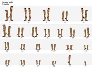  repro chromosome anomalies