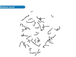 47,XYY 
• 1:1000 male births 
• not APA effect 
• not dysmorphic 
• either incidental prenatal, postnatal 
• tall stature 
• Learning - mainstream school 
• behavioural problems – defiant type, 
• NOT associated with criminality 
• fertile, normal offspring 
 