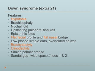 Down syndrome (extra 21) 
Features 
• Hypotonia 
• Brachicephaly 
• Nuchal fold 
• Upslanting palpebral fissures 
• Epicanthic folds 
• Flat facial profile and flat nasal bridge 
• Low placed simple ears, overfolded helixes 
• Brachydactyly 
• Clinodactyly 
• Simian palmar crease 
• Sandal gap- wide space // toes 1 & 2 
 