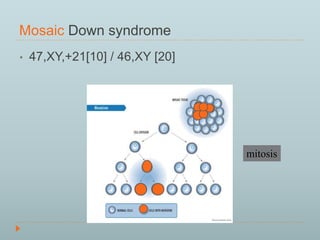 Mosaic Down syndrome 
• 47,XY,+21[10] / 46,XY [20] 
mitosis 
 