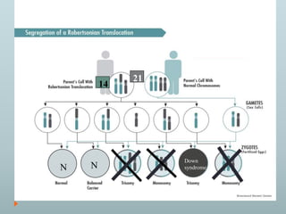 14 
21 
N NN 
Down 
syndrome 
 