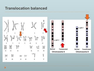Translocation balanced 
 