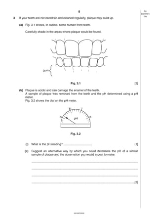8
0610/6/O/N/02
For
Examiner’s
Use
3 If your teeth are not cared for and cleaned regularly, plaque may build up.
(a) Fig. 3.1 shows, in outline, some human front teeth.
Carefully shade in the areas where plaque would be found.
Fig. 3.1 [2]
(b) Plaque is acidic and can damage the enamel of the teeth.
A sample of plaque was removed from the teeth and the pH determined using a pH
meter.
Fig. 3.2 shows the dial on the pH meter.
Fig. 3.2
(i) What is the pH reading? ................................... [1]
(ii) Suggest an alternative way by which you could determine the pH of a similar
sample of plaque and the observation you would expect to make.
...................................................................................................................................
...................................................................................................................................
...................................................................................................................................
...............................................................................................................................[2]
pH5
6
8
7
gum
 