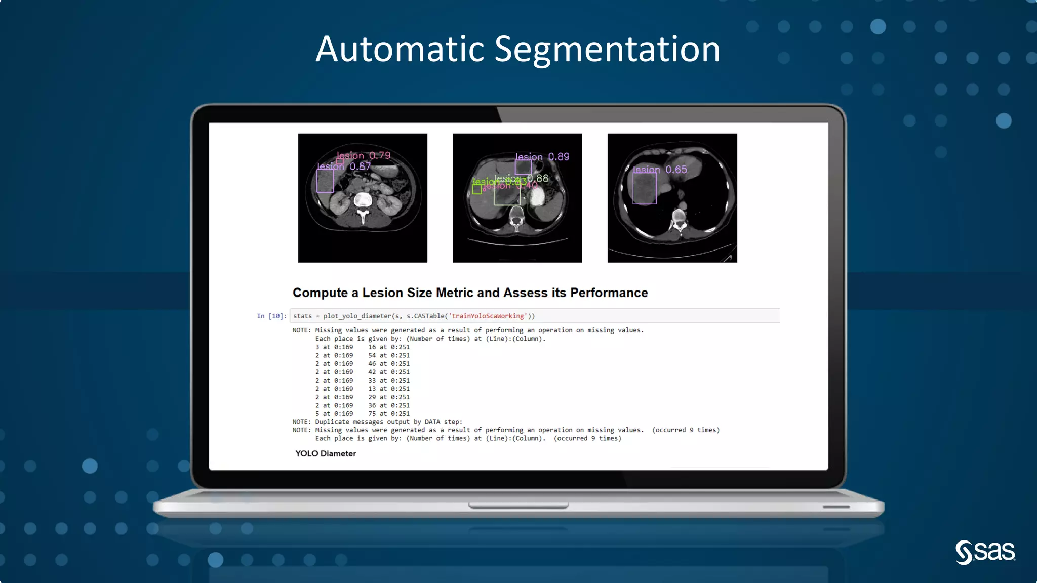 Automatic Segmentation
 
