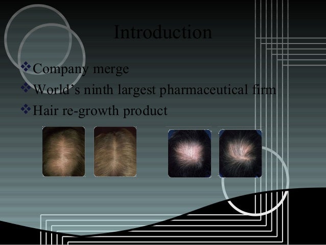 pharmacia and upjohn inc rogaine hair regrowth treatment Factual summary: company profile: pharmacia & upjohn, inc was created with the merger of pharmacia ab of sweden and the upjohn company of us in 1995 pharmaceutical products account for 90% of company sales almost 70% of company sales are made outside usa. pharmacia and upjohn inc rogaine hair regrowth treatment Factual summary: company profile: pharmacia & upjohn, inc was created with the merger of pharmacia ab of sweden and the upjohn company of us in 1995 pharmaceutical products account for 90% of company sales almost 70% of company sales are made outside usa.