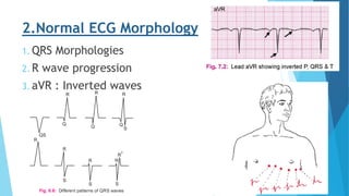 ECG slides shaza PDF | PPT