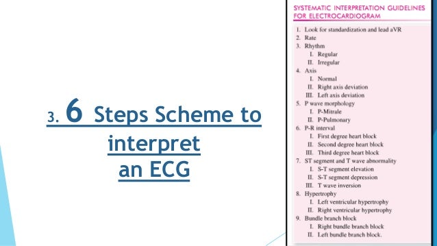 Ecg Slides Shaza Pdf