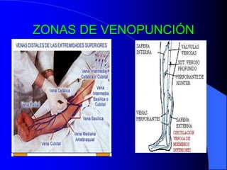 ZONAS DE VENOPUNCIÓN
 