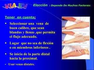 Elección : Depende De Muchos Factores:
Tener en cuenta:
 Seleccionar una vena de
buen calibre, que sean
blandas y llenas ,que permita
el flujo adecuado.
 Lugar que no sea de flexión
o en miembros inferiores .
 Se inicia de la parte distal
hacia la proximal.
 Usar venas dístales.
 