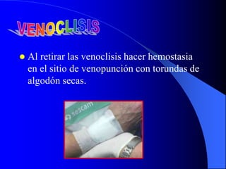  Al retirar las venoclisis hacer hemostasia
en el sitio de venopunción con torundas de
algodón secas.
 
