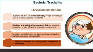 06 Acute Laryngitis and Bacterial Tracheitis_260210_211336.pdf
