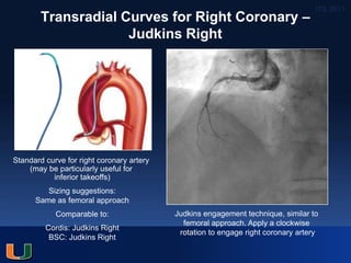 06 aimradial2016 thu2 MG Cohen Guiding catheters | PPTX