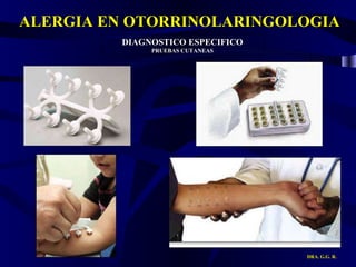 ALERGIA EN OTORRINOLARINGOLOGIA DRA. G.G. R. DIAGNOSTICO ESPECIFICO PRUEBAS CUTANEAS 