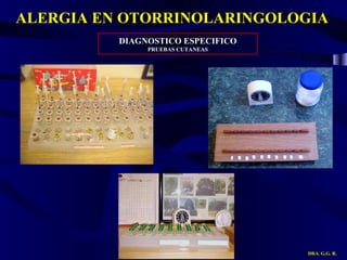 ALERGIA EN OTORRINOLARINGOLOGIA DRA. G.G. R. DIAGNOSTICO ESPECIFICO PRUEBAS CUTANEAS 