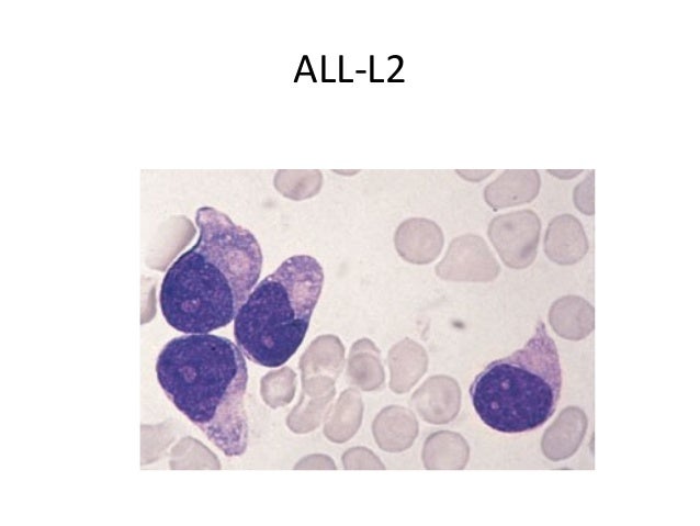 what is the rarest form of leukemia aml vs all what is the rarest form of leukemia aml vs all