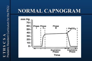 06 capnography and pulseoximetry | PPT