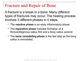A fracture is a break in a bone. Many different
types of fractures may occur. The healing process
involves 3 different phases in 4 steps.
 The reactive phase is an early inflammatory phase.
 The reparative phase includes formation of a
fibrocartilaginous callus first and a bony callus second.
 The bone remodeling phase is the last step as the bony
callus is remodeled.
Fracture and Repair of Bone
Copyright © 2014 John Wiley & Sons, Inc. All rights reserved.
 