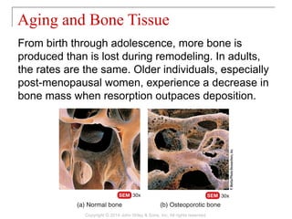 From birth through adolescence, more bone is
produced than is lost during remodeling. In adults,
the rates are the same. Older individuals, especially
post-menopausal women, experience a decrease in
bone mass when resorption outpaces deposition.
Aging and Bone Tissue
Copyright © 2014 John Wiley & Sons, Inc. All rights reserved.
 