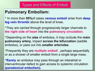 Large Emboli Circulatory disroders in radiography distrubances | PPT