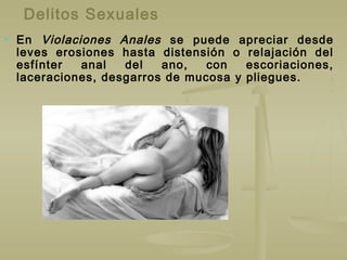 Delitos Sexuales
 En Violaciones Anales se puede apreciar desde
leves erosiones hasta distensión o relajación del
esfínter anal del ano, con escoriaciones,
laceraciones, desgarros de mucosa y pliegues.
 