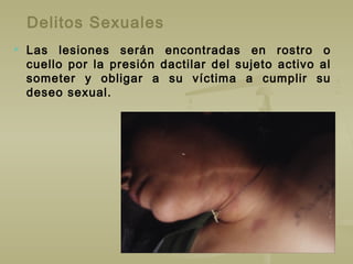 Delitos Sexuales
 Las lesiones serán encontradas en rostro o
cuello por la presión dactilar del sujeto activo al
someter y obligar a su víctima a cumplir su
deseo sexual.
 