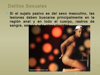Delitos Sexuales
 Si el sujeto pasivo es del sexo masculino, las
lesiones deben buscarse principalmente en la
región anal y en todo el cuerpo, rastros de
sangre, semen o de otros líquidos.
 