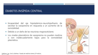 Diabetes insípida PPTX