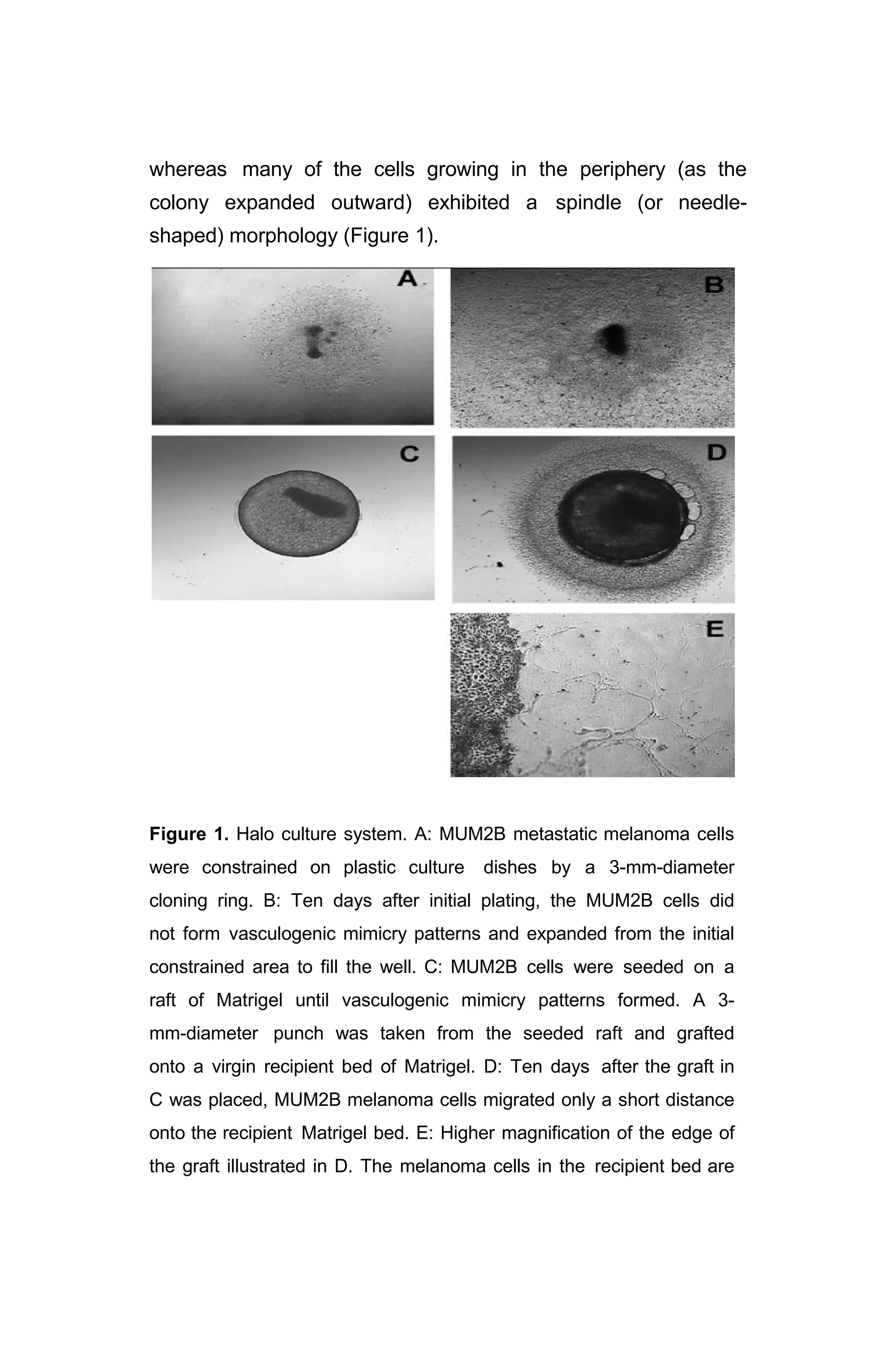 whereas many of the cells growing in the periphery (as the
colony expanded outward) exhibited a spindle (or needle-
shaped) morphology (Figure 1).
Figure 1. Halo culture system. A: MUM2B metastatic melanoma cells
were constrained on plastic culture dishes by a 3-mm-diameter
cloning ring. B: Ten days after initial plating, the MUM2B cells did
not form vasculogenic mimicry patterns and expanded from the initial
constrained area to fill the well. C: MUM2B cells were seeded on a
raft of Matrigel until vasculogenic mimicry patterns formed. A 3-
mm-diameter punch was taken from the seeded raft and grafted
onto a virgin recipient bed of Matrigel. D: Ten days after the graft in
C was placed, MUM2B melanoma cells migrated only a short distance
onto the recipient Matrigel bed. E: Higher magnification of the edge of
the graft illustrated in D. The melanoma cells in the recipient bed are
 