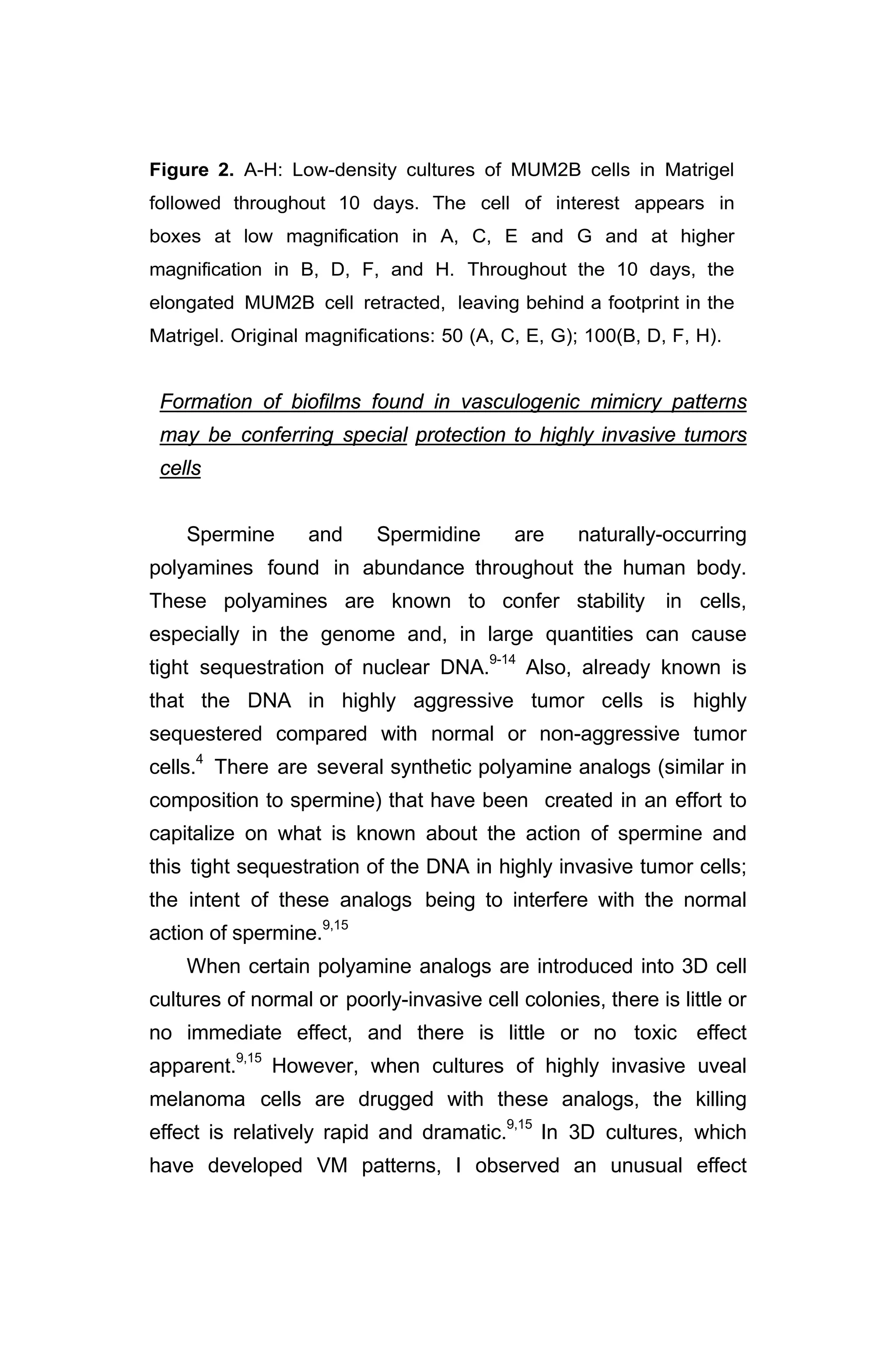 Figure 2. A-H: Low-density cultures of MUM2B cells in Matrigel
followed throughout 10 days. The cell of interest appears in
boxes at low magnification in A, C, E and G and at higher
magnification in B, D, F, and H. Throughout the 10 days, the
elongated MUM2B cell retracted, leaving behind a footprint in the
Matrigel. Original magnifications: 50 (A, C, E, G); 100(B, D, F, H).
Formation of biofilms found in vasculogenic mimicry patterns
may be conferring special protection to highly invasive tumors
cells
Spermine and Spermidine are naturally-occurring
polyamines found in abundance throughout the human body.
These polyamines are known to confer stability in cells,
especially in the genome and, in large quantities can cause
tight sequestration of nuclear DNA.9-14
Also, already known is
that the DNA in highly aggressive tumor cells is highly
sequestered compared with normal or non-aggressive tumor
cells.4
There are several synthetic polyamine analogs (similar in
composition to spermine) that have been created in an effort to
capitalize on what is known about the action of spermine and
this tight sequestration of the DNA in highly invasive tumor cells;
the intent of these analogs being to interfere with the normal
action of spermine.9,15
When certain polyamine analogs are introduced into 3D cell
cultures of normal or poorly-invasive cell colonies, there is little or
no immediate effect, and there is little or no toxic effect
apparent.9,15
However, when cultures of highly invasive uveal
melanoma cells are drugged with these analogs, the killing
effect is relatively rapid and dramatic.9,15
In 3D cultures, which
have developed VM patterns, I observed an unusual effect
 